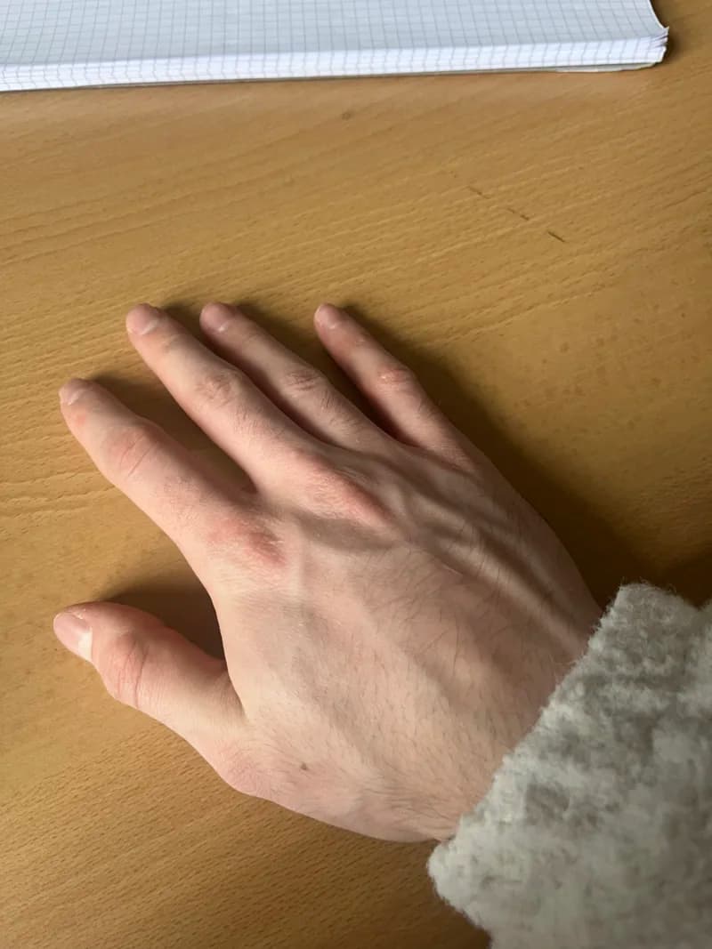 Jonas Mitis – Foto 3